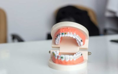 The Best Oral Hygiene Routine for Braces